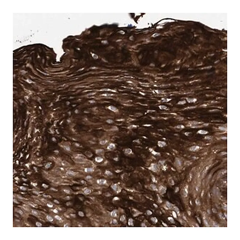 Merck Anti-KRT24 antibody produced in rabbit