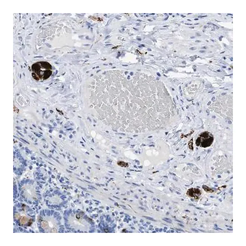 Merck Anti-ANKFN1 antibody produced in rabbit