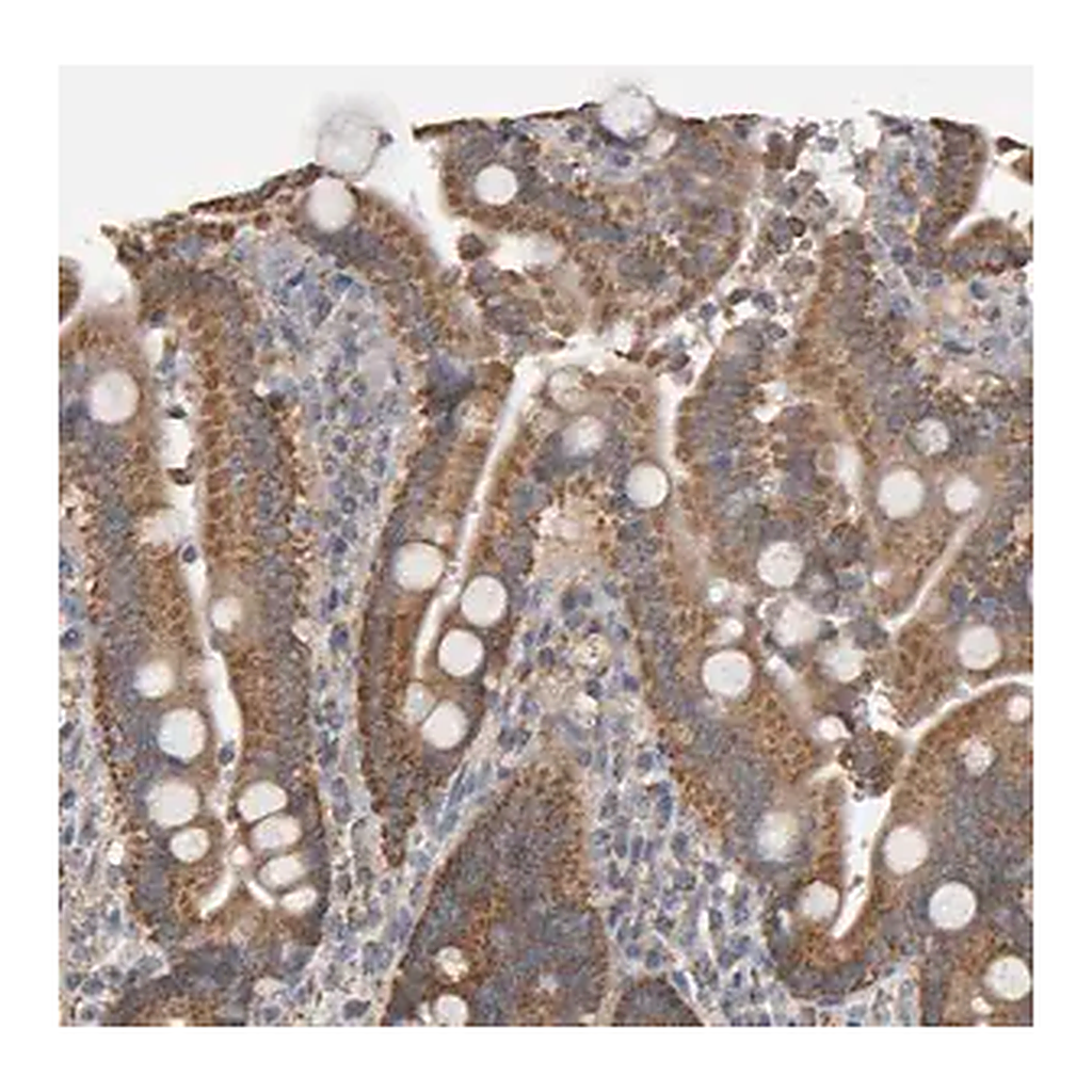 Merck Anti-TOM1L1 antibody produced in rabbit