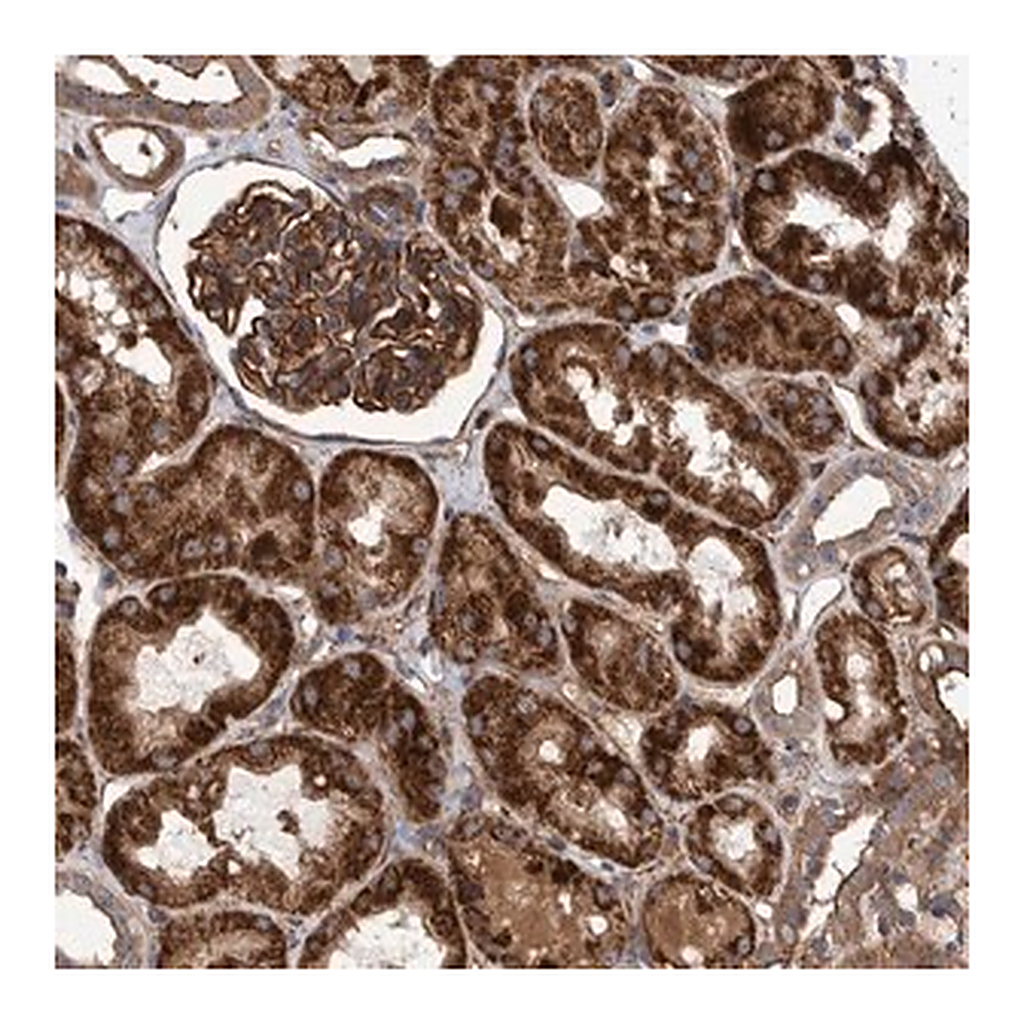 Merck Anti-SLC25A10 antibody produced in rabbit