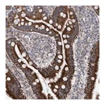 Merck Anti-ZNF566 antibody produced in rabbit