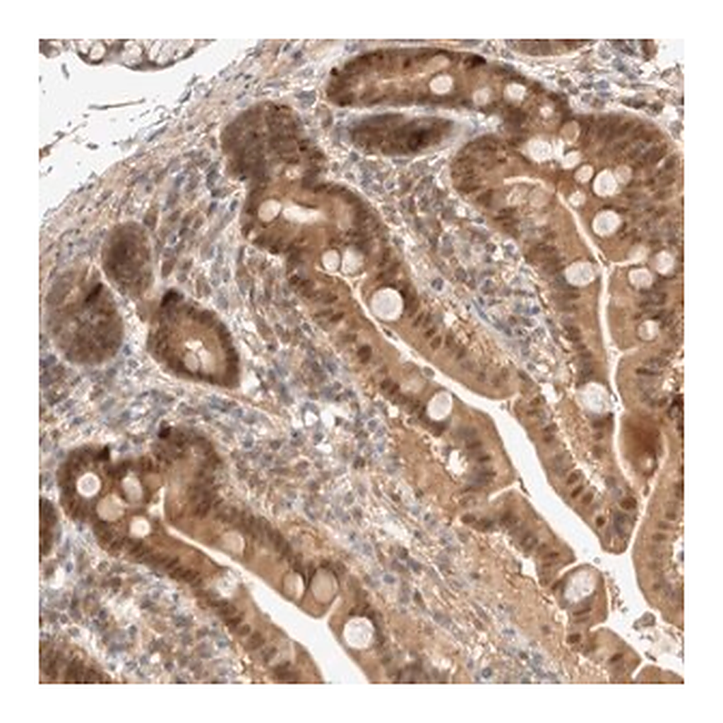 Merck Anti-CARNMT1 antibody produced in rabbit