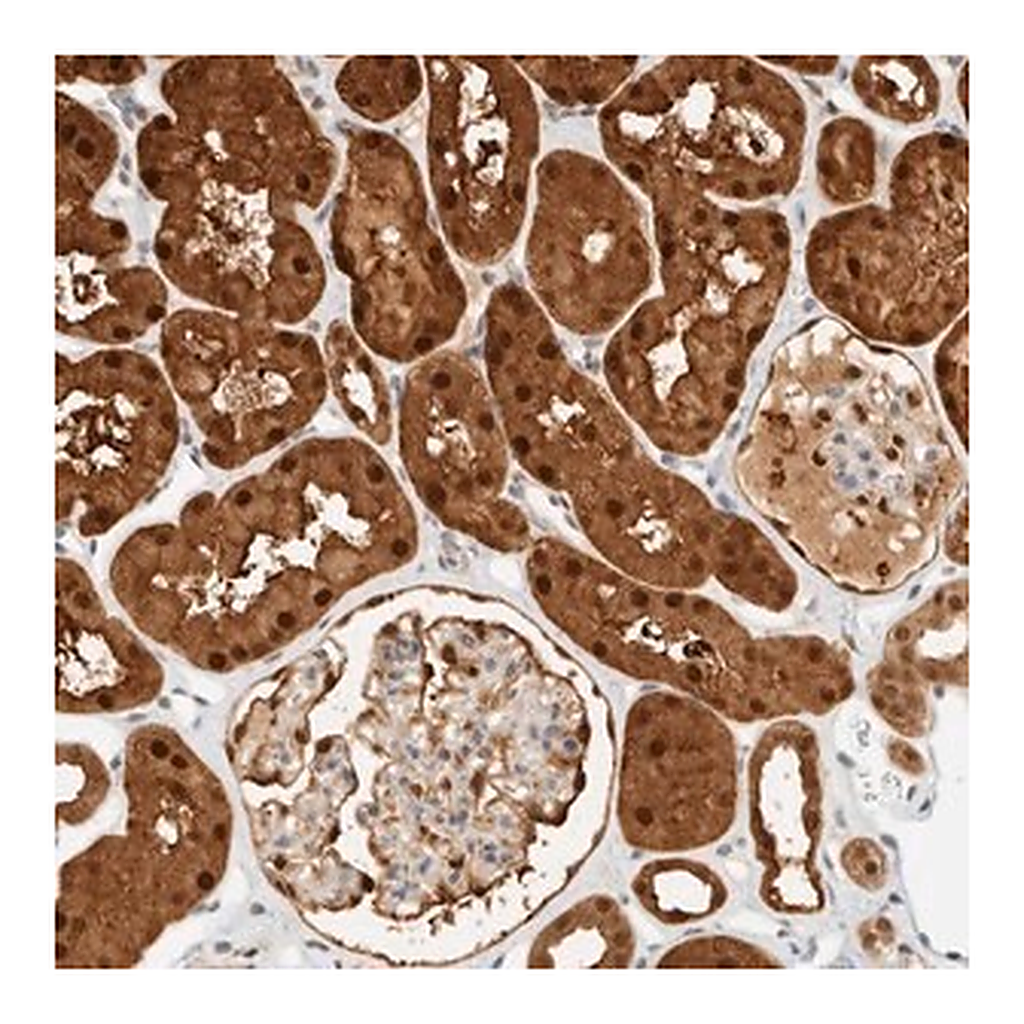 Merck Anti-ZBTB37 antibody produced in rabbit