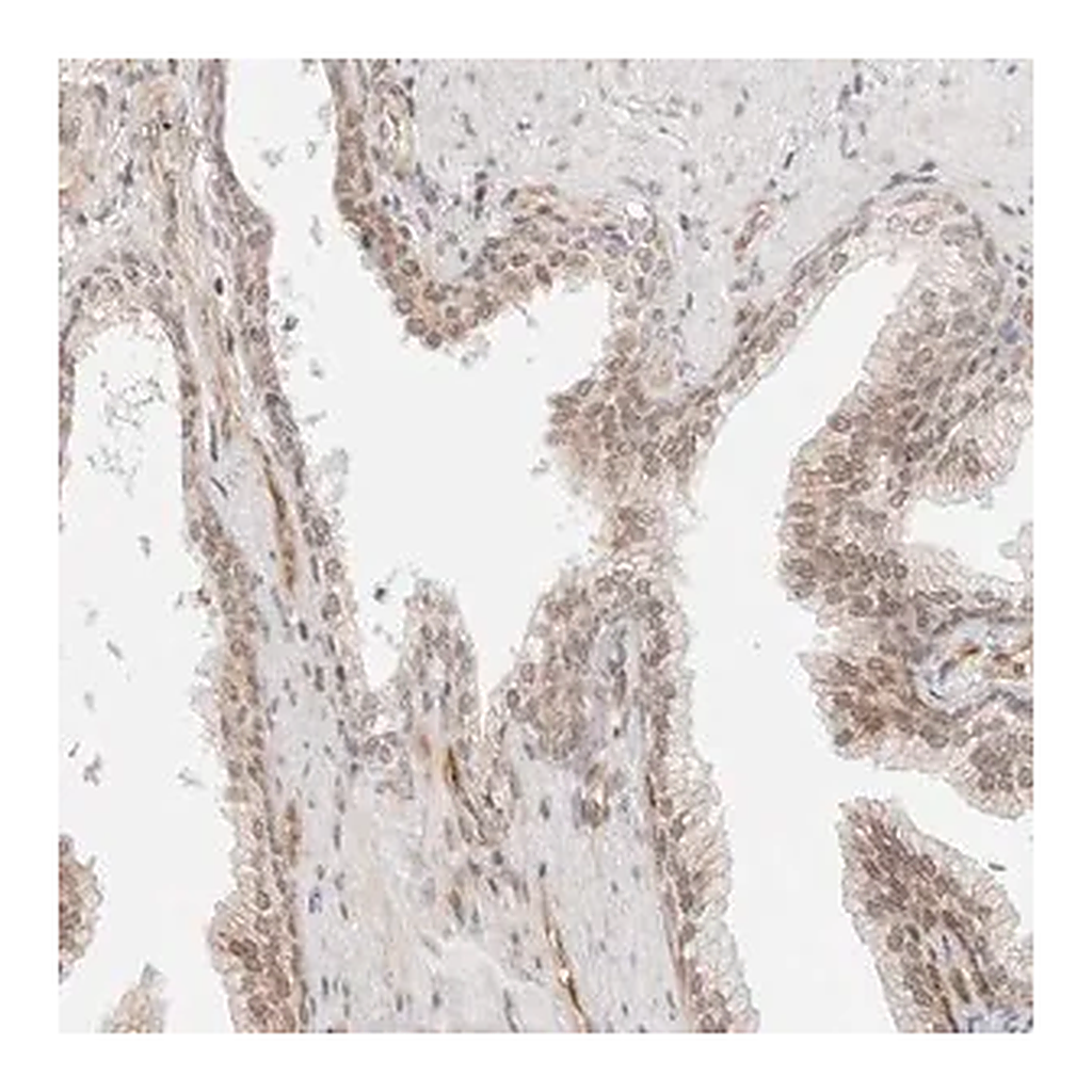 Merck Anti-ZNF613 antibody produced in rabbit