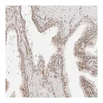 Merck Anti-ZNF613 antibody produced in rabbit