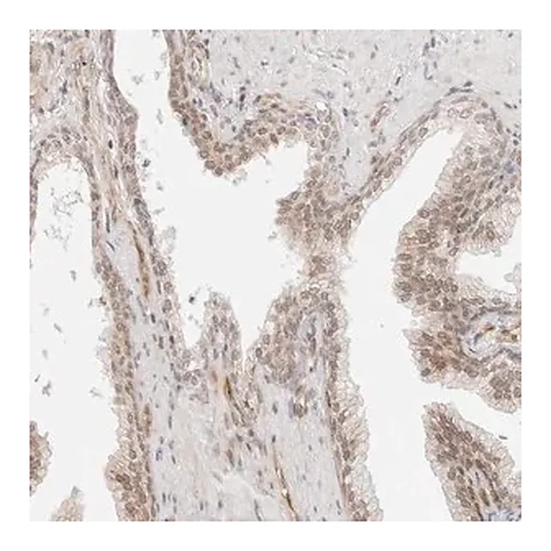 Merck Anti-ZNF613 antibody produced in rabbit