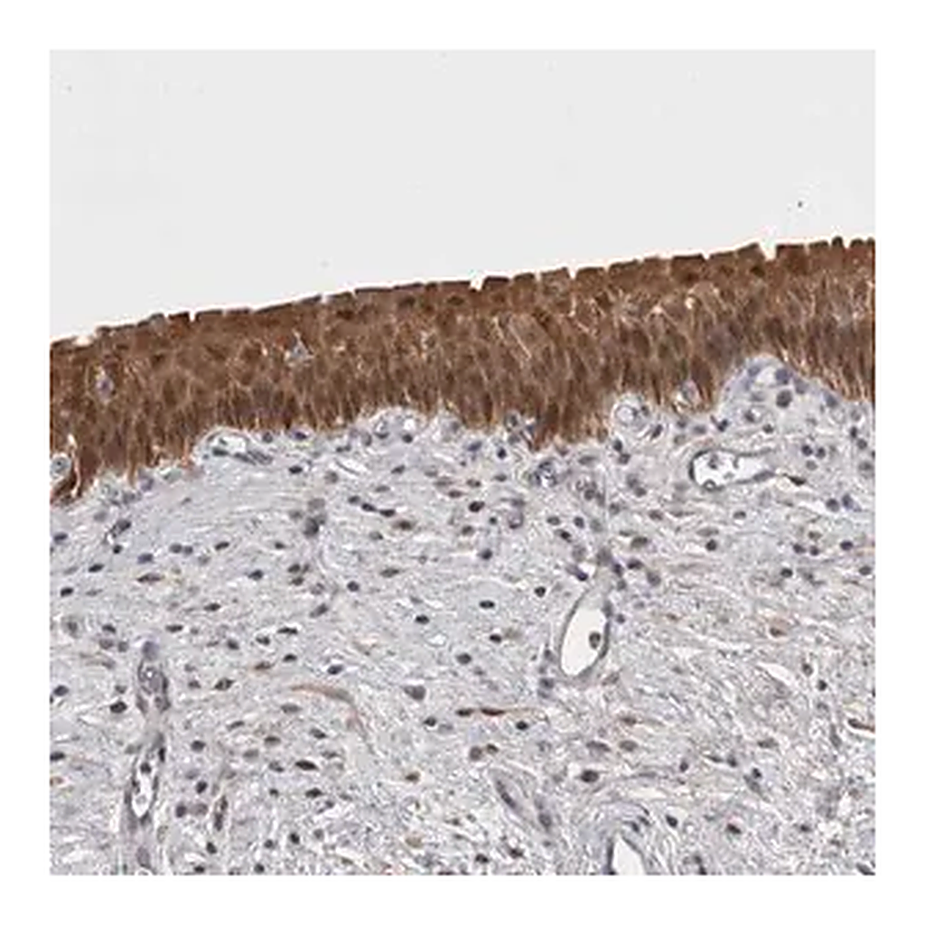 Merck Anti-CHIC2 antibody produced in rabbit
