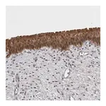 Merck Anti-CHIC2 antibody produced in rabbit