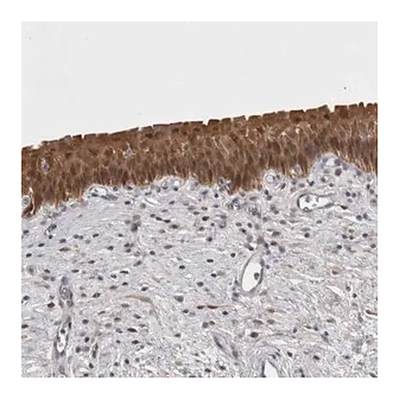 Merck Anti-CHIC2 antibody produced in rabbit