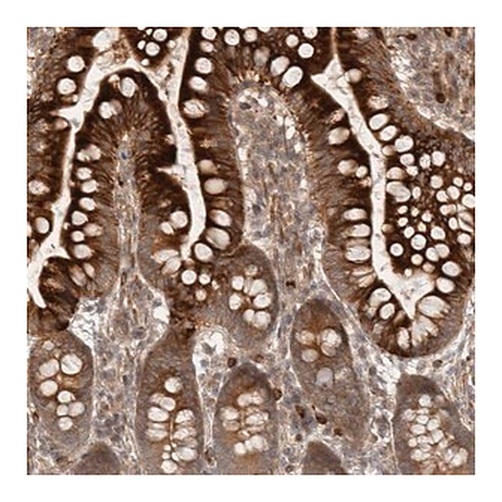Merck Anti-CCPG1 antibody produced in rabbit