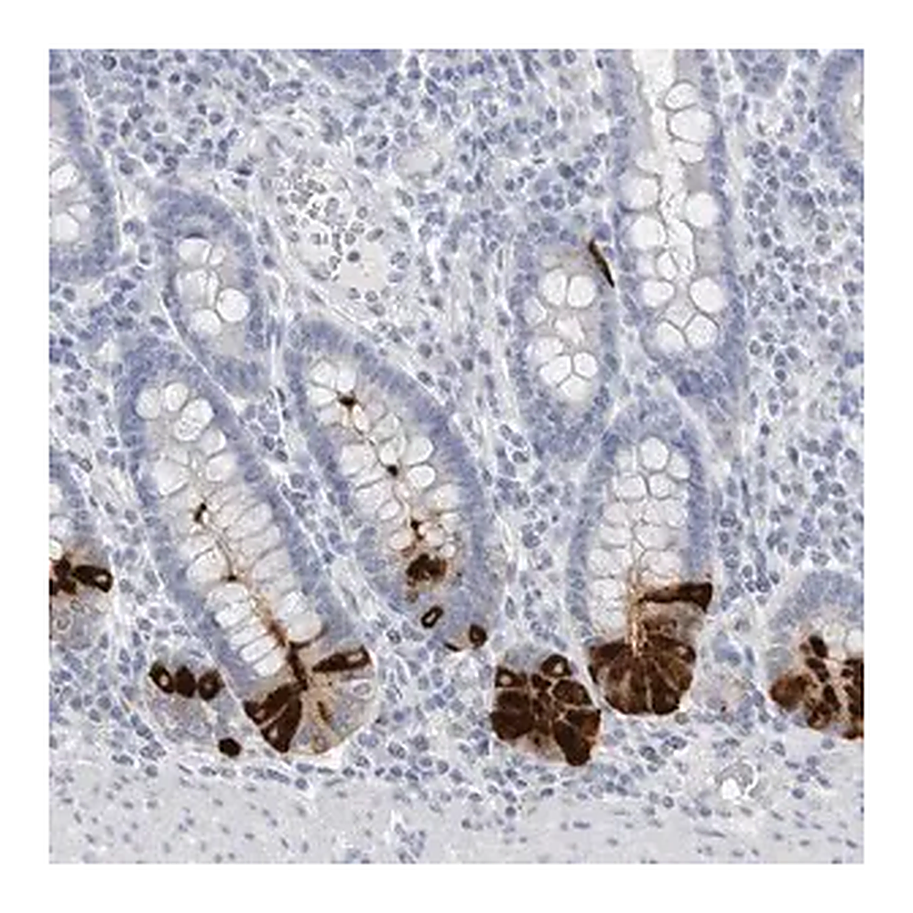 Merck Anti-ABHD12 antibody produced in rabbit