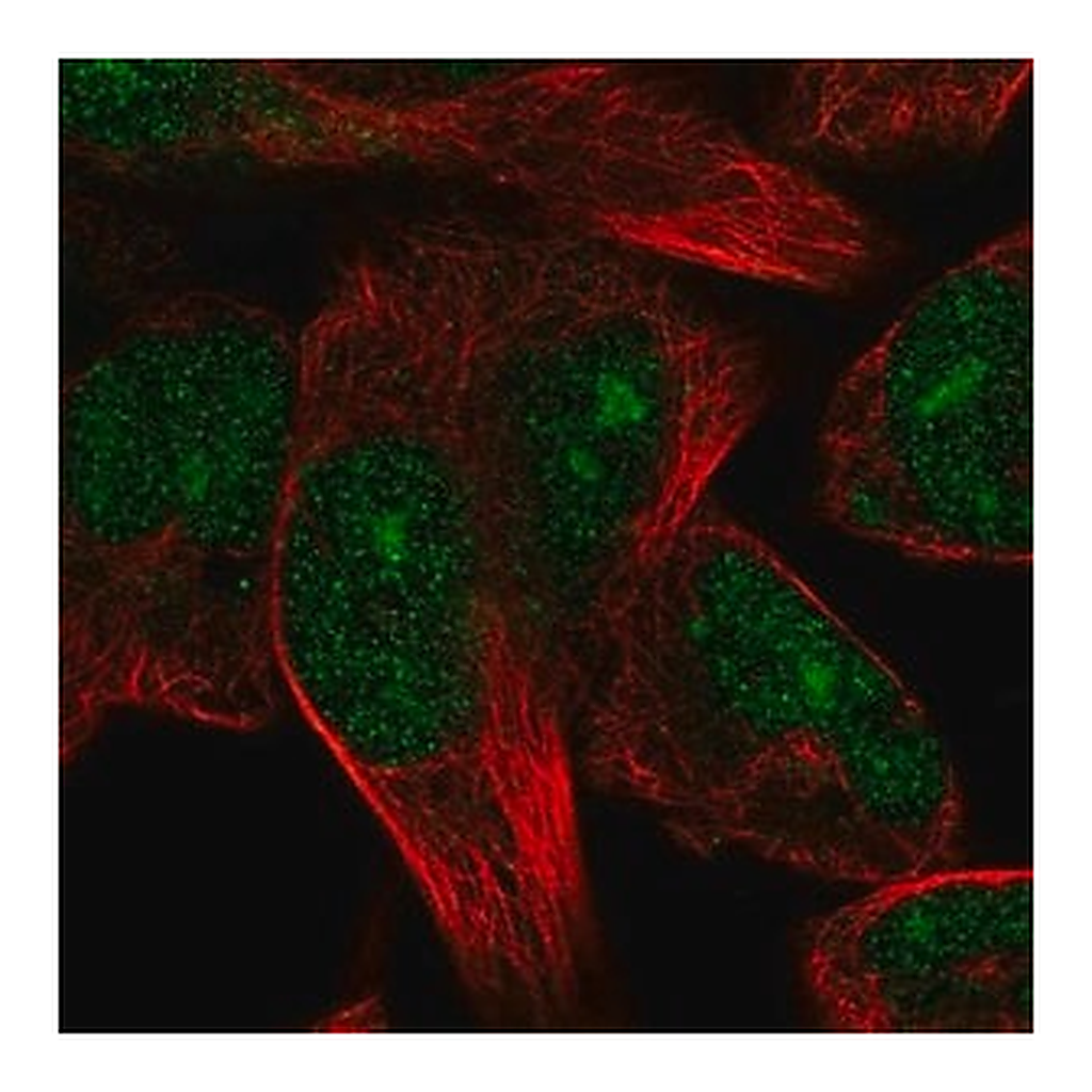 Merck Anti-TRIM72 antibody produced in rabbit