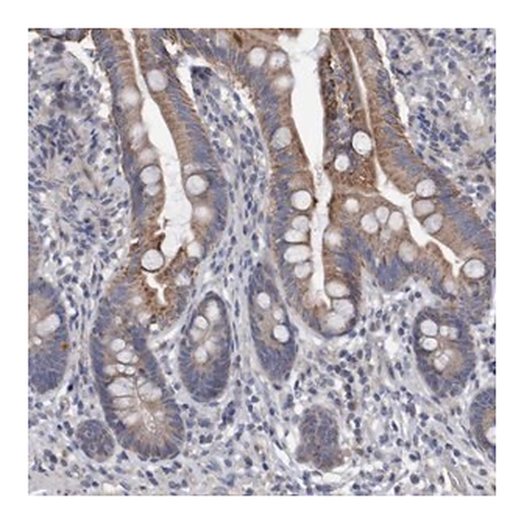 Merck Anti-DDHD2 antibody produced in rabbit
