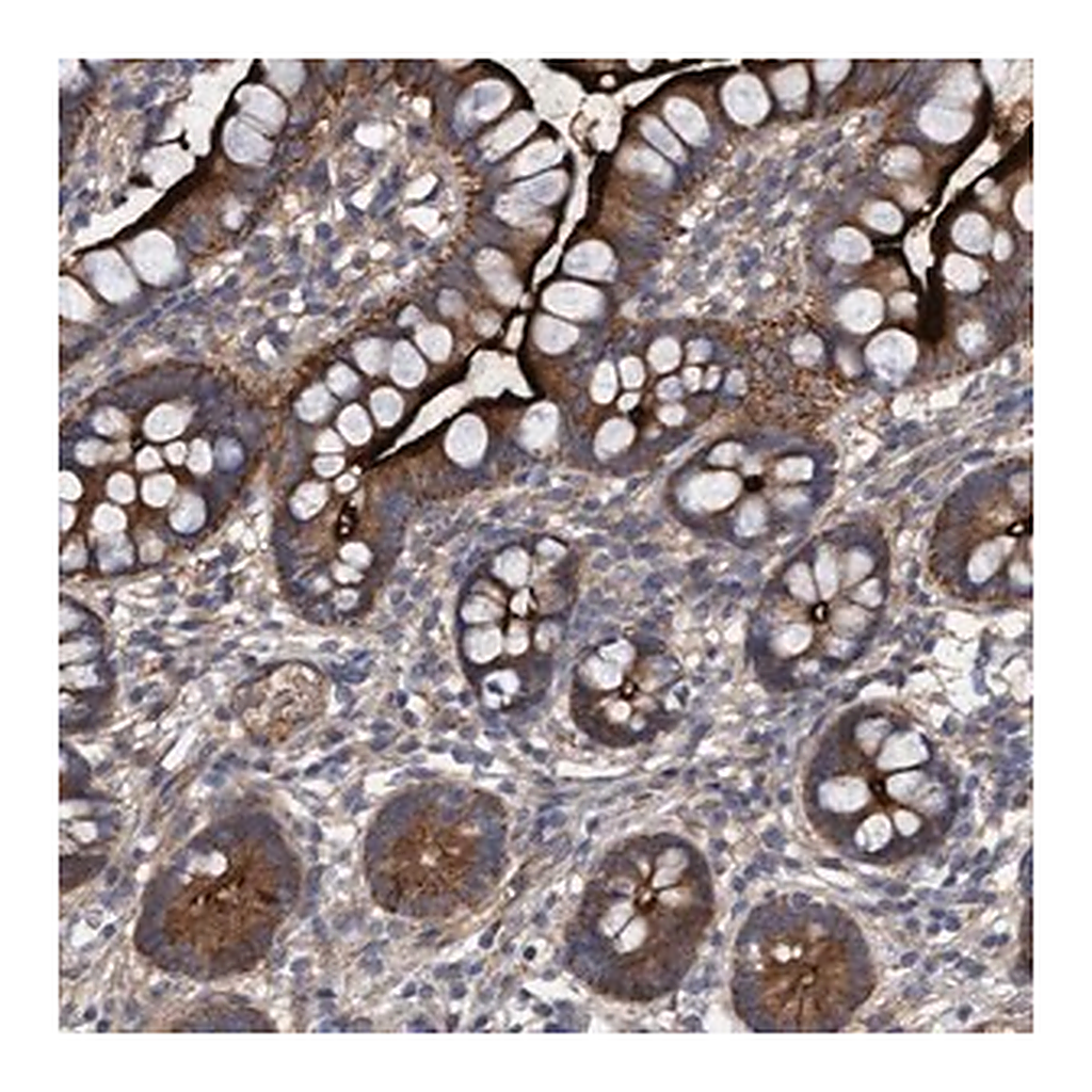 Merck Anti-DDHD2 antibody produced in rabbit