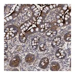 Merck Anti-DDHD2 antibody produced in rabbit