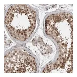 Merck Anti-ZNF341 antibody produced in rabbit