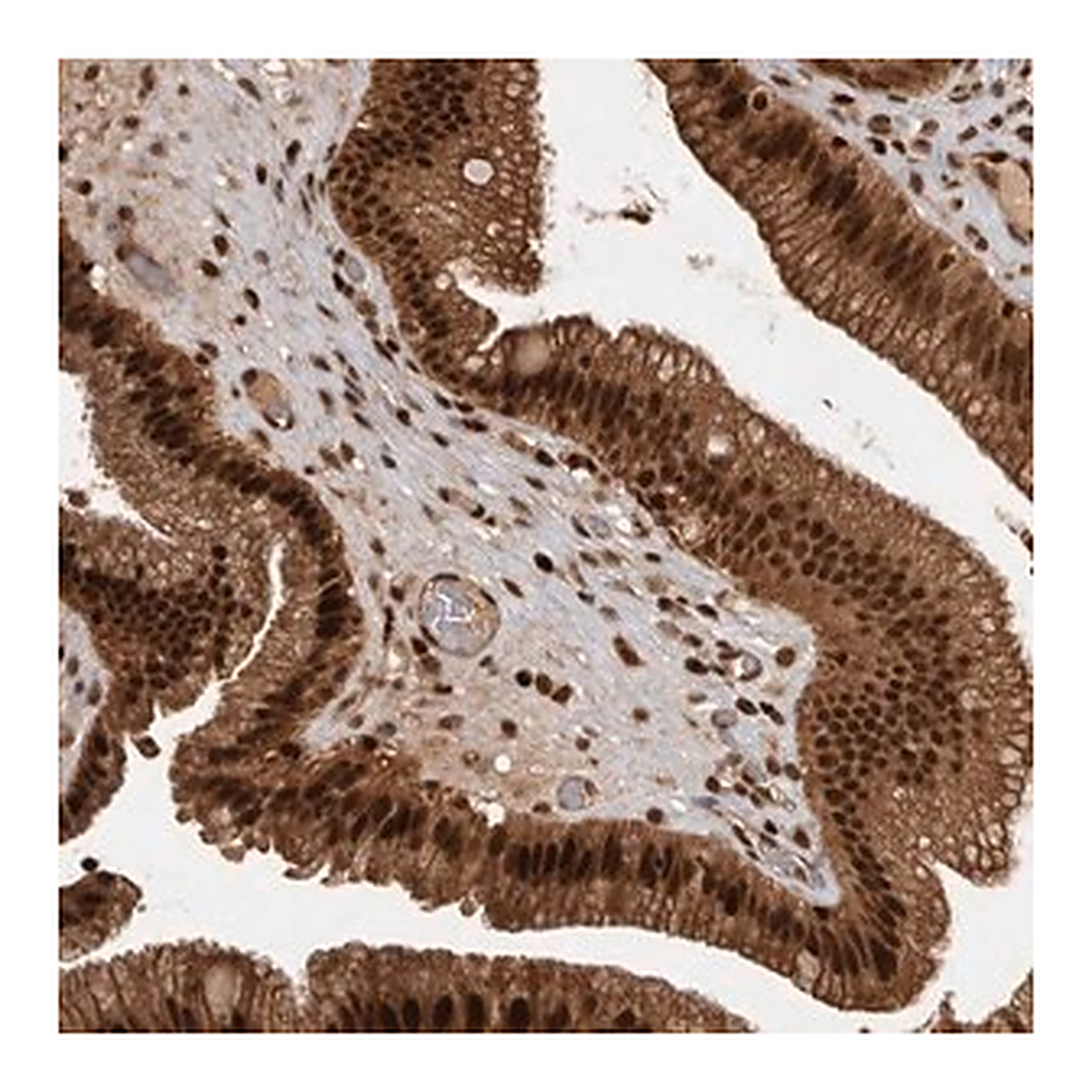 Merck Anti-RPS6KA4 antibody produced in rabbit