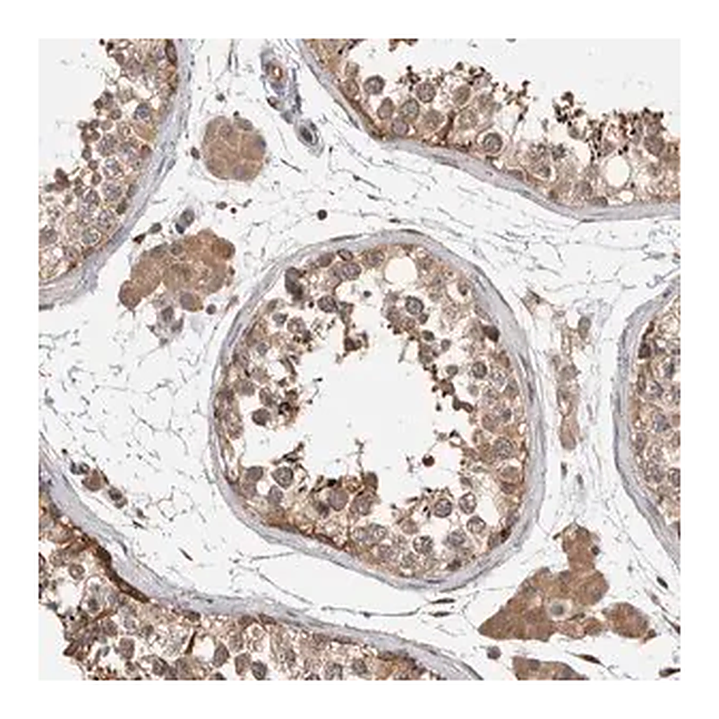 Merck Anti-PARP6 antibody produced in rabbit
