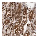 Merck Anti-UTS2B antibody produced in rabbit