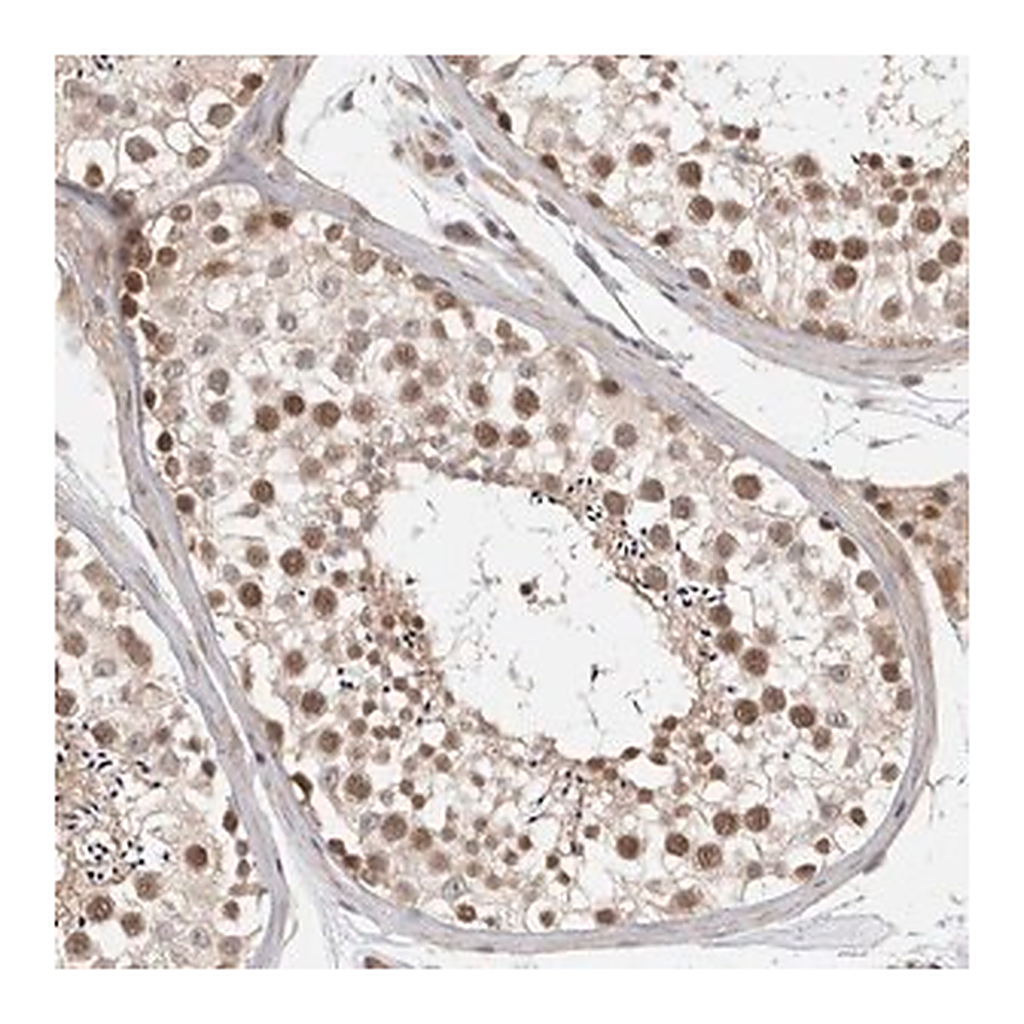 Merck Anti-ZNF318 antibody produced in rabbit