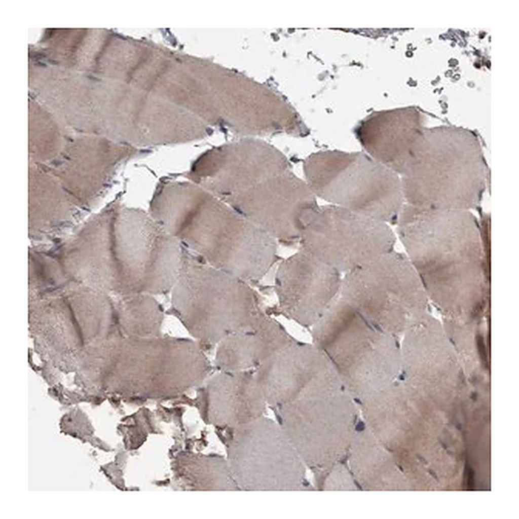 Merck Anti-PPP1R3C antibody produced in rabbit