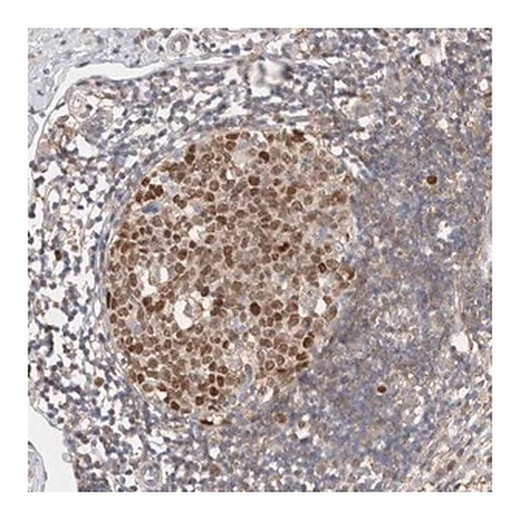 Merck Anti-CDCA7L antibody produced in rabbit