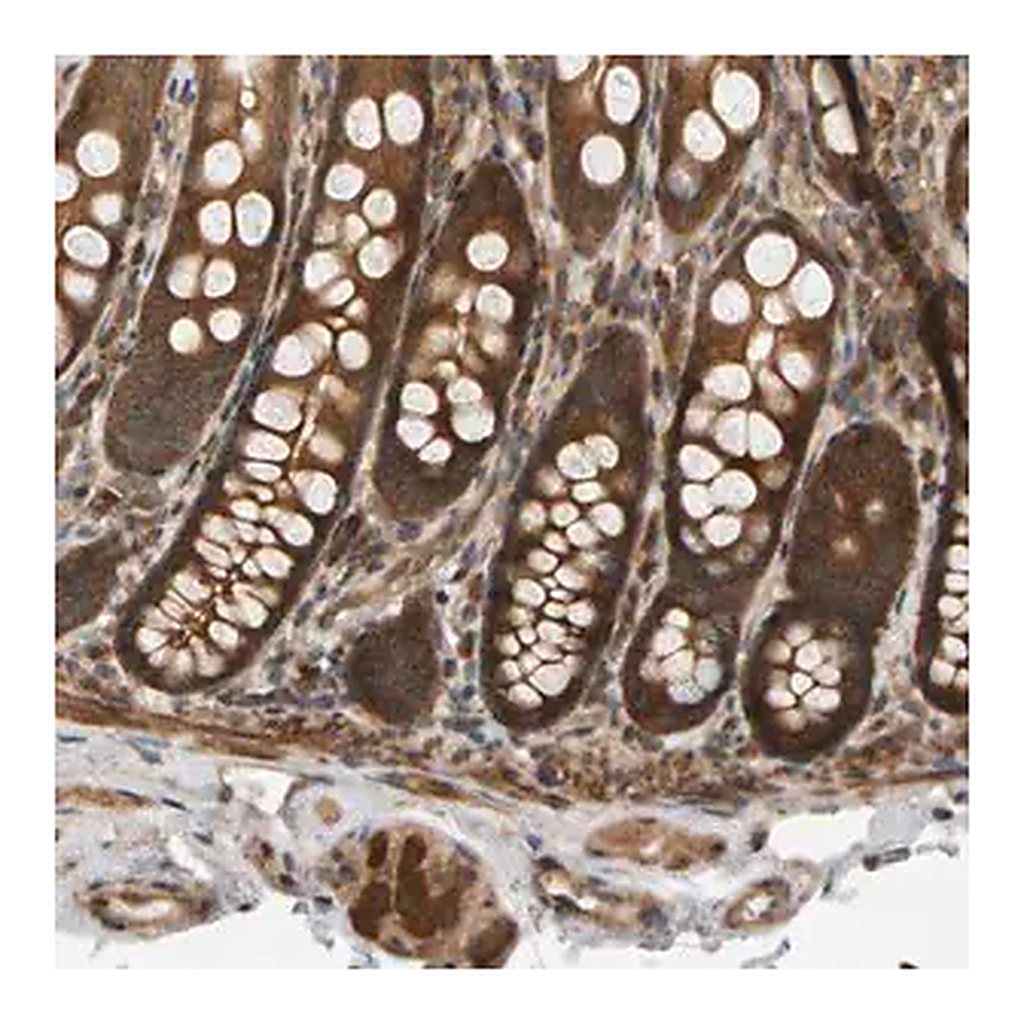 Merck Anti-BAHCC1 antibody produced in rabbit