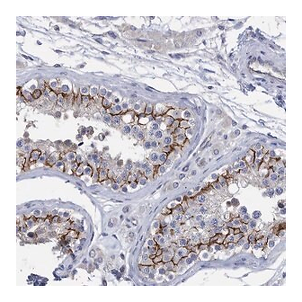 Merck Anti-PPP3CC antibody produced in rabbit