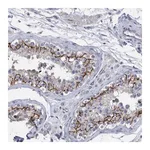 Merck Anti-PPP3CC antibody produced in rabbit