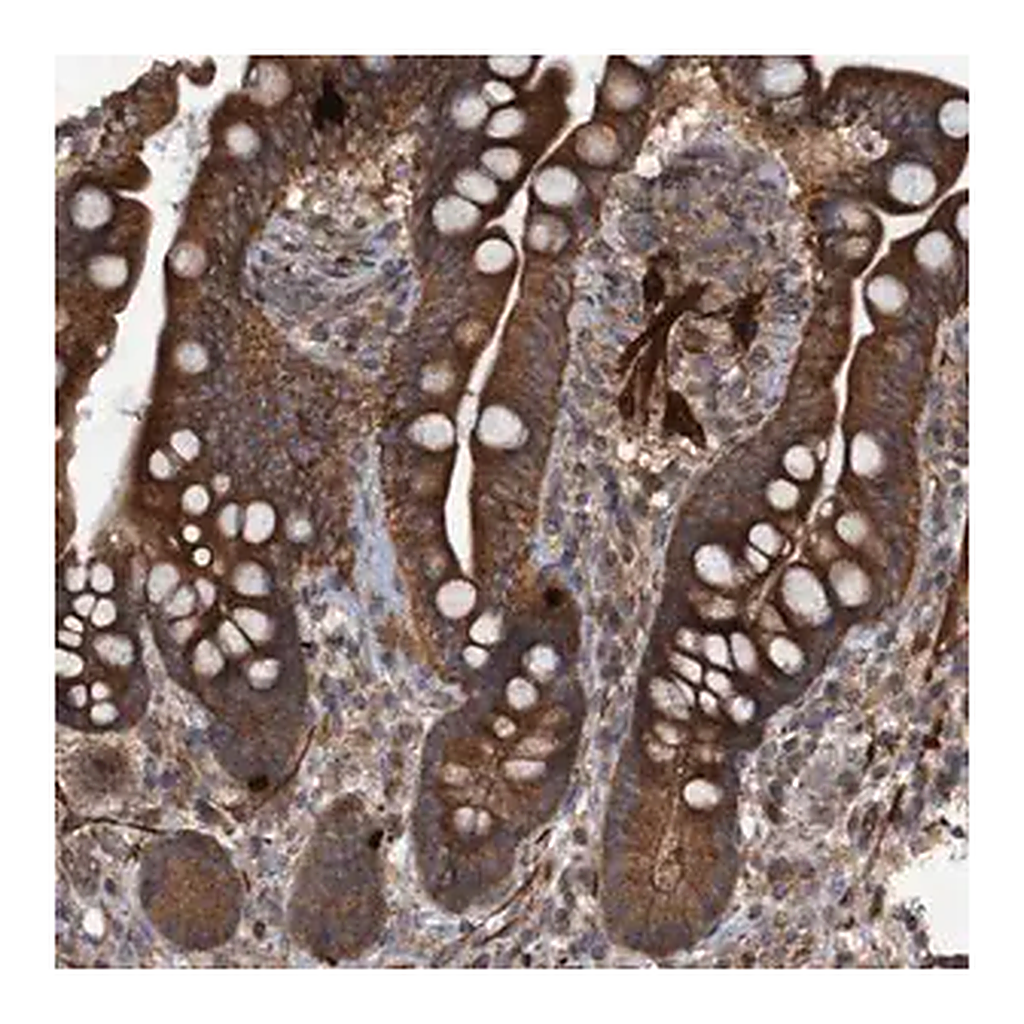 Merck Anti-GGT6 antibody produced in rabbit