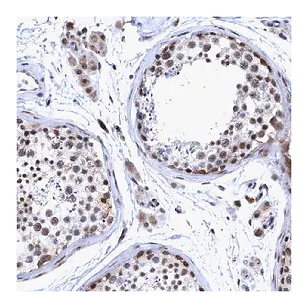 Merck Anti-GLT6D1 antibody produced in rabbit
