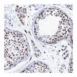 Merck Anti-GLT6D1 antibody produced in rabbit