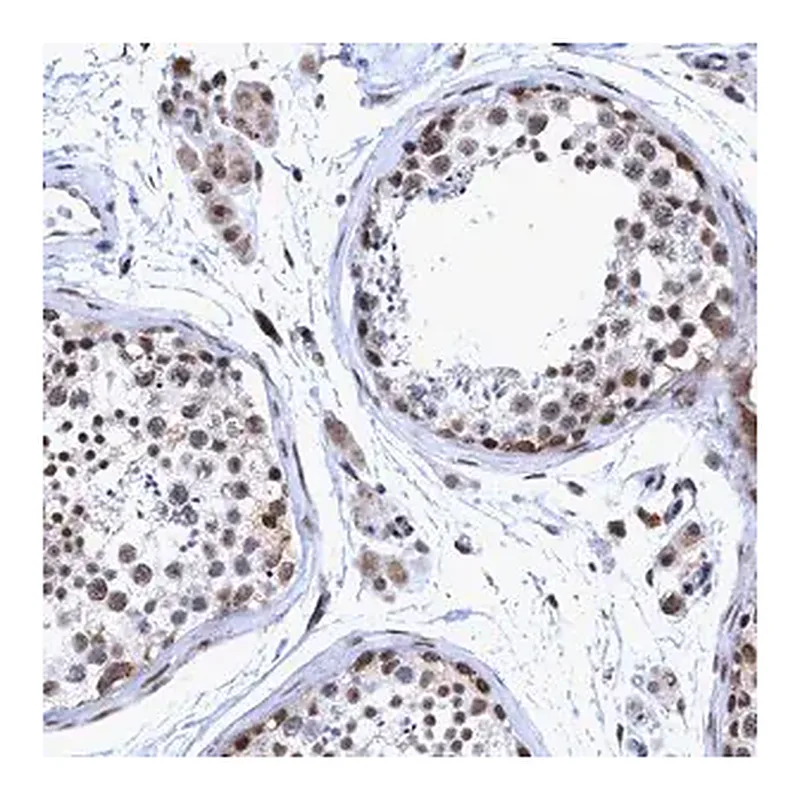 Merck Anti-GLT6D1 antibody produced in rabbit