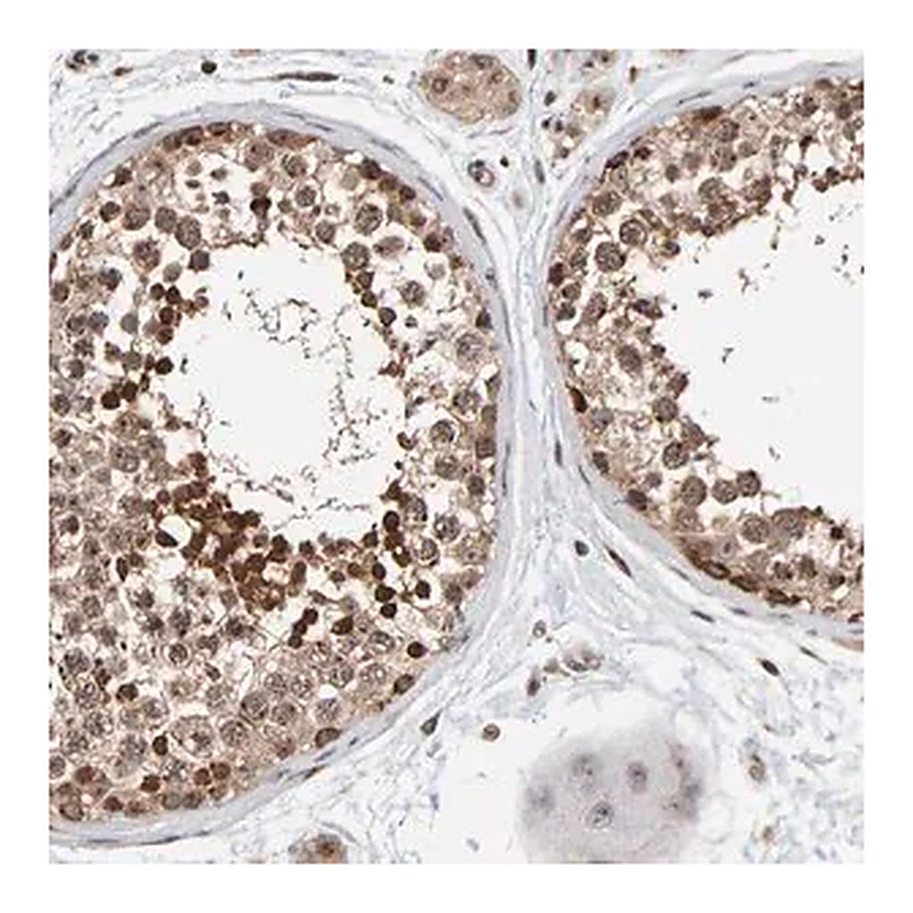 Merck Anti-CCDC182 antibody produced in rabbit
