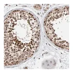 Merck Anti-CCDC182 antibody produced in rabbit