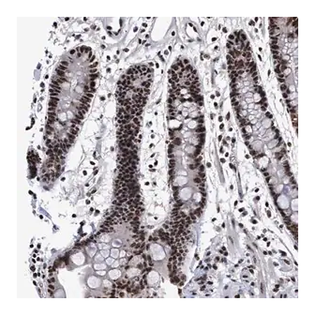 Merck Anti-EFCAB10 antibody produced in rabbit