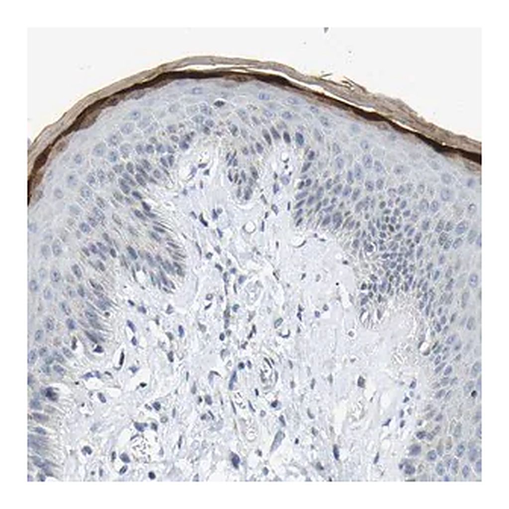 Merck Anti-KRT76 antibody produced in rabbit