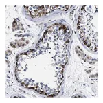 Merck Anti-OR10G3 antibody produced in rabbit
