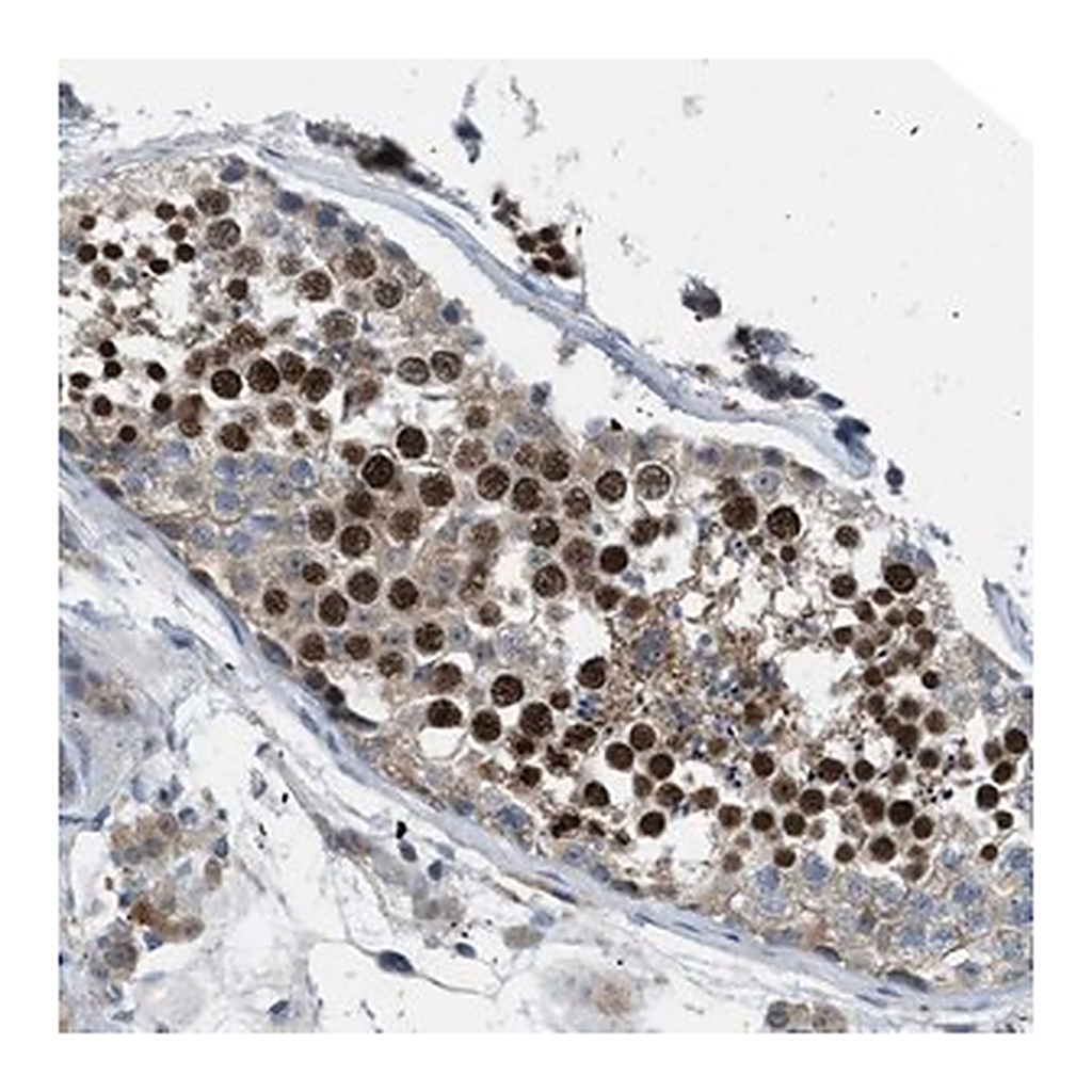 Merck Anti-BAZ2B antibody produced in rabbit