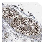 Merck Anti-BAZ2B antibody produced in rabbit