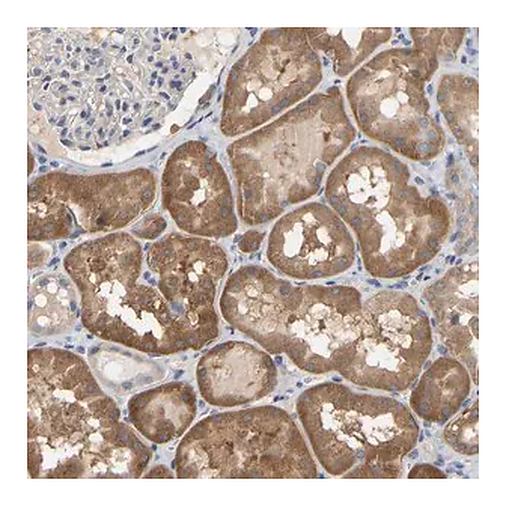 Merck Anti-SSH1 antibody produced in rabbit
