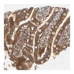 Merck Anti-TPMT antibody produced in rabbit