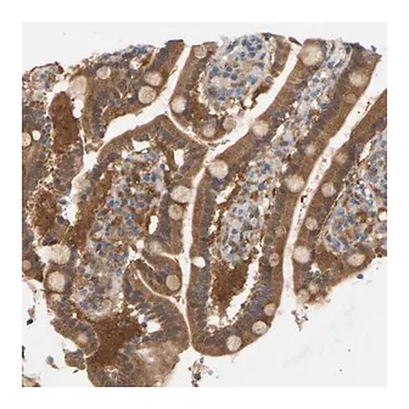 Merck Anti-TPMT antibody produced in rabbit