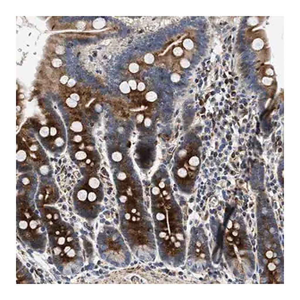 Merck Anti-IL17RC antibody produced in rabbit
