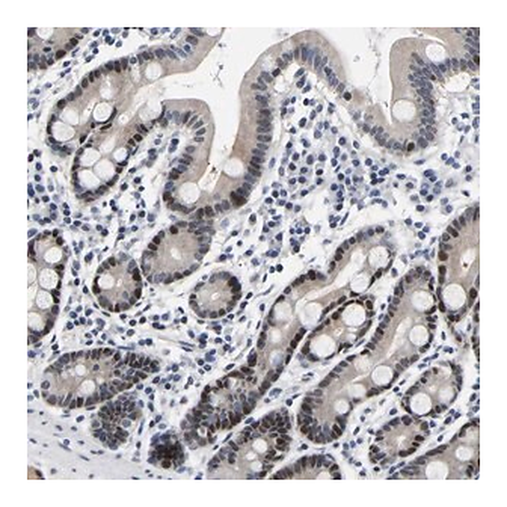 Merck Anti-PTRHD1 antibody produced in rabbit