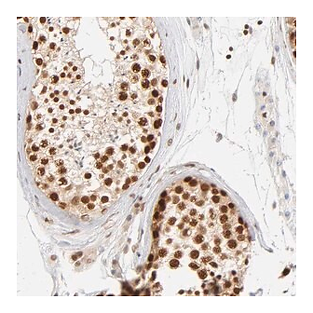 Merck Anti-ILKAP antibody produced in rabbit
