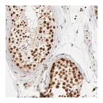 Merck Anti-ILKAP antibody produced in rabbit