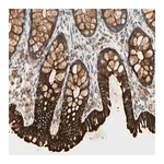 Merck Anti-SKIL antibody produced in rabbit