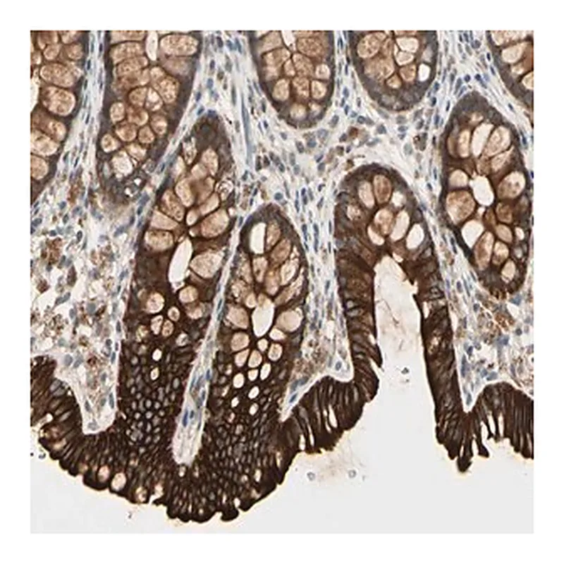 Merck Anti-SKIL antibody produced in rabbit