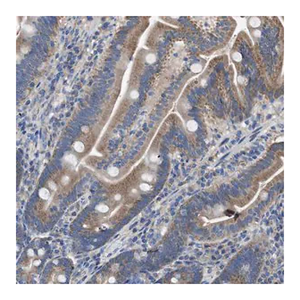 Merck Anti-DOLPP1 antibody produced in rabbit